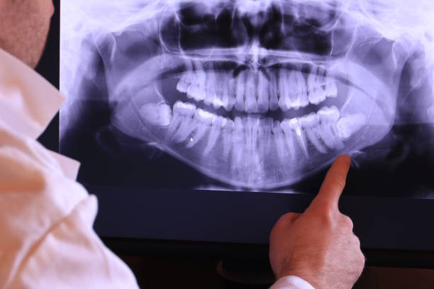 Best Emergency Dentist for Special Needs Patients in Moville, IA